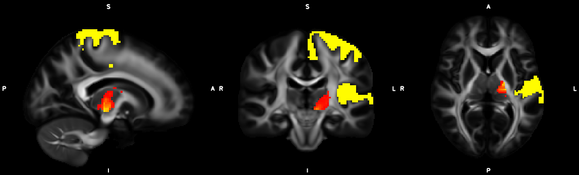 Yeo7_sensorimotor