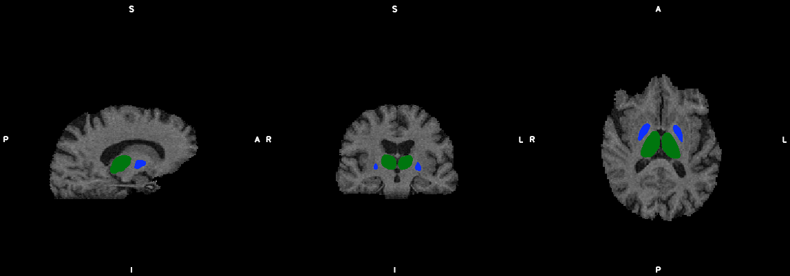 first_segmentation