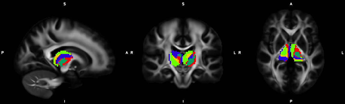 kmeans_thalamus