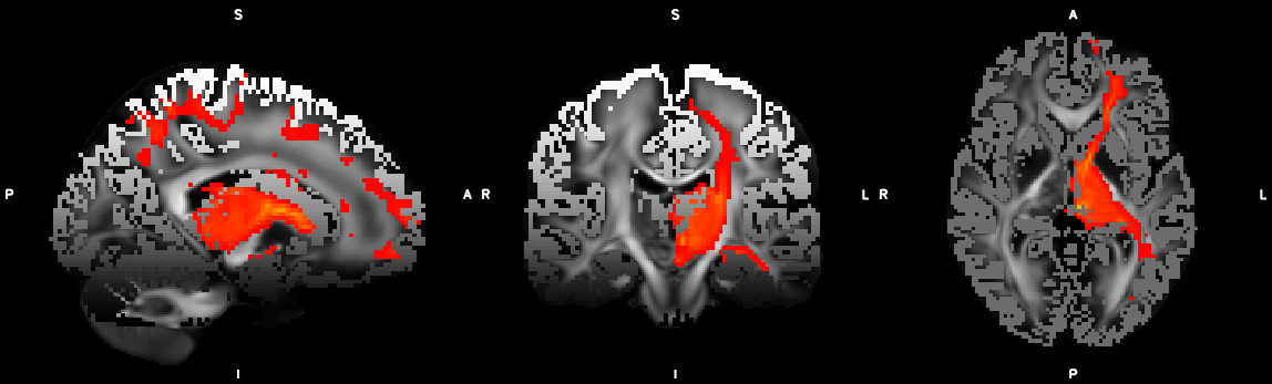 omatrix2_thalamus_setup