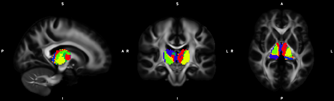 thalamic_segmentation_2methods